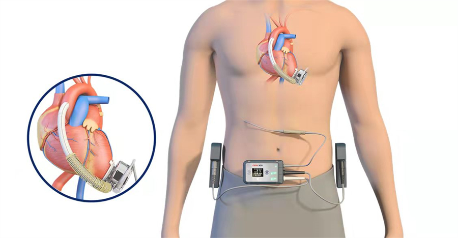 1676530772493039v3hb.jpg 微信图片_20211126124921.jpg